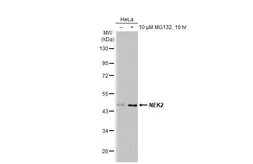 Anti-NEK2 antibody [HL2511] used in Western Blot (WB). GTX638872