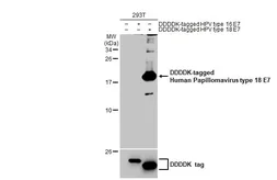 Anti-Human Papillomavirus type 18 E7 antibody [HL2522] used in Western Blot (WB). GTX638883