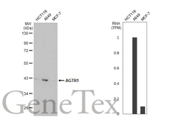 Anti-AGTR1 antibody [HL2524] used in Western Blot (WB). GTX638885