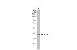 Anti-AGTR1 antibody [HL2524] used in Western Blot (WB). GTX638885