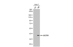 Anti-AGTR1 antibody [HL2526] used in Western Blot (WB). GTX638887