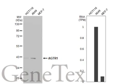 Anti-AGTR1 antibody [HL2526] used in Western Blot (WB). GTX638887