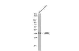 Anti-GSX2 antibody [HL2533] used in Western Blot (WB). GTX638902