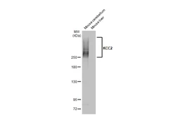 Anti-KCC2 antibody [HL2535] used in Western Blot (WB). GTX638904