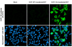Anti-EGFR VIII antibody [HL2541] used in Immunocytochemistry/ Immunofluorescence (ICC/IF). GTX638910