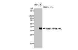 Anti-Mpox virus A5L antibody [HL2555] used in Western Blot (WB). GTX638927