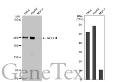 Anti-ROBO1 antibody [HL2559] used in Western Blot (WB). GTX638936