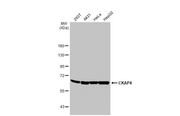 Anti-CKAP4 antibody [HL2562] used in Western Blot (WB). GTX638940