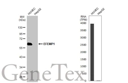Anti-EFEMP1 antibody [HL2572] used in Western Blot (WB). GTX638950