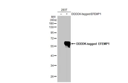 Anti-EFEMP1 antibody [HL2572] used in Western Blot (WB). GTX638950