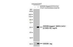 Anti-SARS-CoV-2 (COVID-19) nsp14 antibody [HL2578] used in Western Blot (WB). GTX638956
