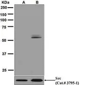 Anti-Src (phospho Tyr416) antibody [EPR6239(2)] used in Western Blot (WB). GTX63902