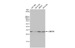Anti-CNOT8 antibody [HL2586] used in Western Blot (WB). GTX639037