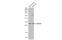 Anti-CNOT8 antibody [HL2586] used in Western Blot (WB). GTX639037