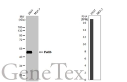 Anti-PAX6 antibody [HL2599] used in Western Blot (WB). GTX639051
