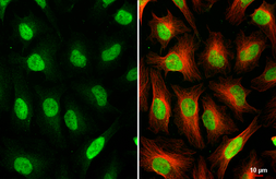 Anti-PAX6 antibody [HL2599] used in Immunocytochemistry/ Immunofluorescence (ICC/IF). GTX639051