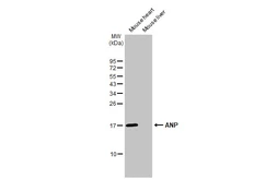 Anti-ANP antibody [HL2617] used in Western Blot (WB). GTX639071