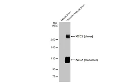 Anti-KCC2 antibody [HL2625] used in Western Blot (WB). GTX639081