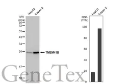 Anti-TMEM41B antibody [HL2628] used in Western Blot (WB). GTX639084