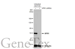 Anti-XPR1 antibody [HL2631] used in Western Blot (WB). GTX639087