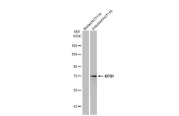 Anti-XPR1 antibody [HL2632] used in Western Blot (WB). GTX639088