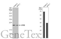 Anti-GPX8 antibody [HL2635] used in Western Blot (WB). GTX639091