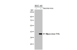 Anti-Mpox virus F13L antibody [HL2637] used in Western Blot (WB). GTX639093