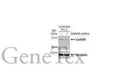 Anti-GnRHR antibody [HL2638] used in Western Blot (WB). GTX639094