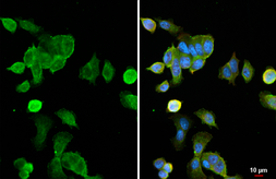 Anti-RAS (G12D Mutant) antibody [HL2640] used in Immunocytochemistry/ Immunofluorescence (ICC/IF). GTX639096