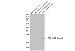 Anti-RAS (G12D Mutant) antibody [HL2640] used in Western Blot (WB). GTX639096