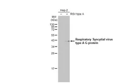 Anti-Respiratory Syncytial virus type A G protein antibody [HL2643] used in Western Blot (WB). GTX639099