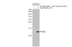 Anti-IL2 antibody [HL2645] used in Western Blot (WB). GTX639104