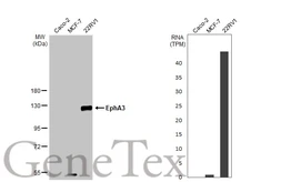 Anti-EphA3 antibody [HL2651] used in Western Blot (WB). GTX639110