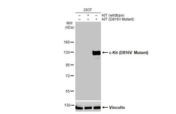 Anti-c-Kit (D816V Mutant) antibody [HL2653] used in Western Blot (WB). GTX639112