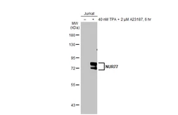 Anti-NUR77 antibody [HL2660] used in Western Blot (WB). GTX639324