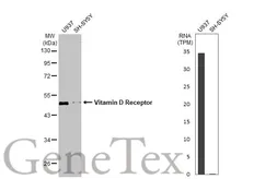 Anti-Vitamin D Receptor antibody [HL2661] used in Western Blot (WB). GTX639325