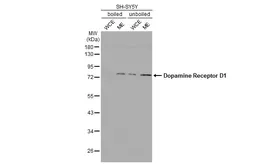 Anti-Dopamine Receptor D1 antibody [HL2680] used in Western Blot (WB). GTX639344
