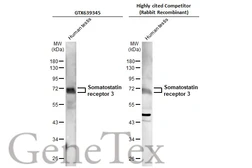 Anti-Somatostatin receptor 3 antibody [HL2681] used in Western Blot (WB). GTX639345