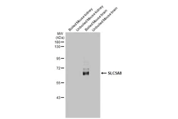 Anti-SLC5A8 antibody [HL2687] used in Western Blot (WB). GTX639352