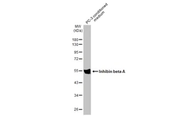 Anti-Inhibin beta A antibody [HL2696] used in Western Blot (WB). GTX639447