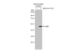 Anti-p53 antibody [HL2699] used in Western Blot (WB). GTX639450
