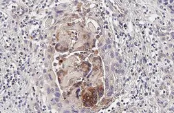Anti-CHI3L1 antibody [HL2708] used in IHC (Paraffin sections) (IHC-P). GTX639462