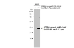 Anti-SARS-CoV-2 (COVID-19) nsp3 / PL-pro antibody [HL2709] used in Western Blot (WB). GTX639463