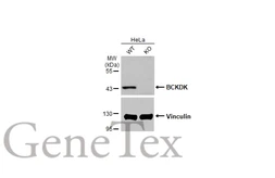 Anti-BCKDK antibody [HL2710] used in Western Blot (WB). GTX639471
