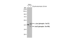 Anti-c-Jun (phospho Ser73) antibody [HL2713] used in Western Blot (WB). GTX639474