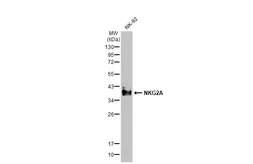 Anti-NKG2A antibody [HL2718] used in Western Blot (WB). GTX639545