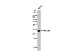 Anti-NKG2A antibody [HL2718] used in Western Blot (WB). GTX639545
