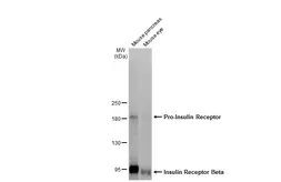 Anti-Insulin Receptor beta antibody [HL2737] used in Western Blot (WB). GTX639566