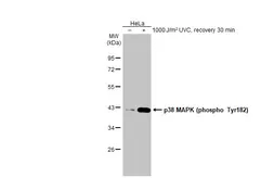 Anti-p38 MAPK (phospho Tyr182) antibody [HL2740] used in Western Blot (WB). GTX639569