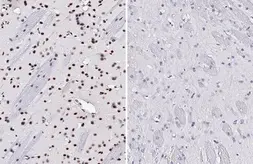 Anti-p38 MAPK (phospho Tyr182) antibody [HL2741] used in IHC (Paraffin sections) (IHC-P). GTX639570